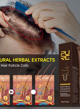好货PURC Hair Growth Products Essentials Anti Hair Loss Roll