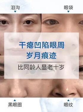 好货眼皮下垂提拉贴防松弛上眼睑去肿定型老年人用提拉紧致双眼皮