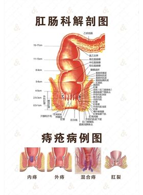 肛肠系统解剖示意图海报肛管与直肠墙贴纸肛肠科解剖图盆腔动脉