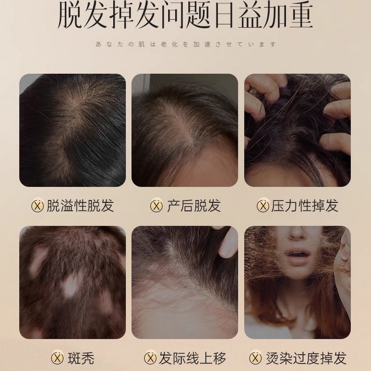 诗风语防脱去屑控油洗发水蓬松柔顺生姜强韧洗发露滋养护发洗头膏