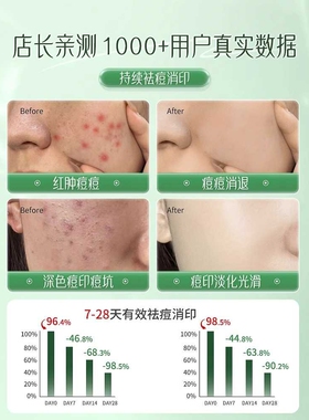 致朵水杨酸面膜祛痘淡化痘印非修复去痘坑痘疤闭口正品控油保湿