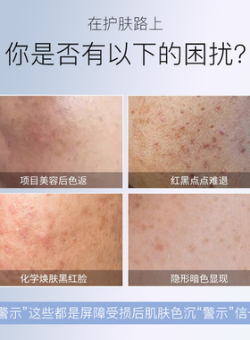 首研官方正品氨甲环酸精华液传明酸5%高浓度熊果苷乳膏保湿焕颜