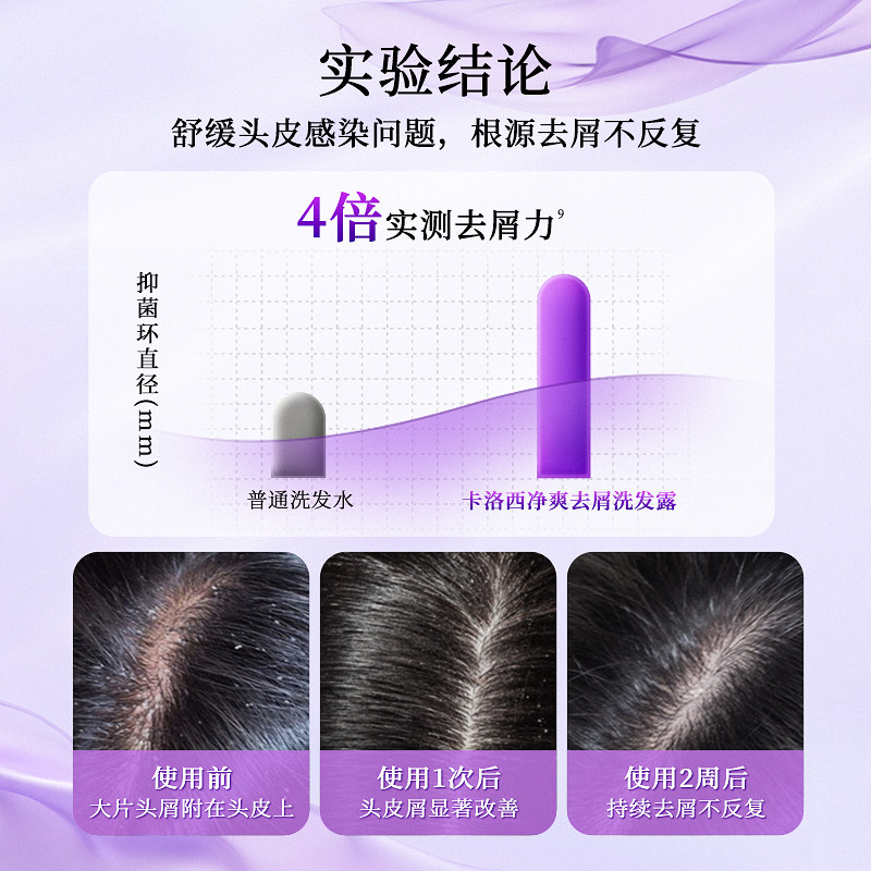 【直播推荐】卡洛西氨基酸洗发水蓬松控油去屑柔顺清洁洗发露