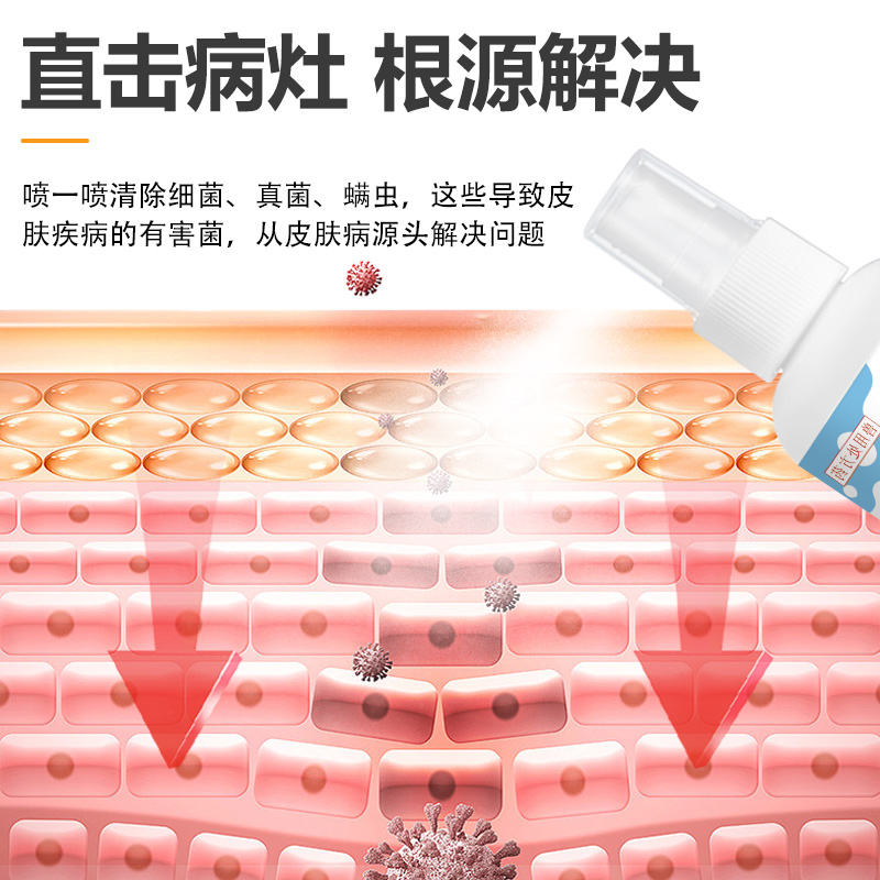 雷迪特肤舒宁皮肤喷剂猫藓狗癣外用药真菌感染宠物掉毛皮肤病修复 - 图1
