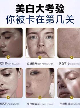 修正美白淡斑精华液淡化色斑正品