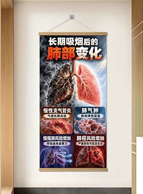 医院禁烟肺部变化警示画