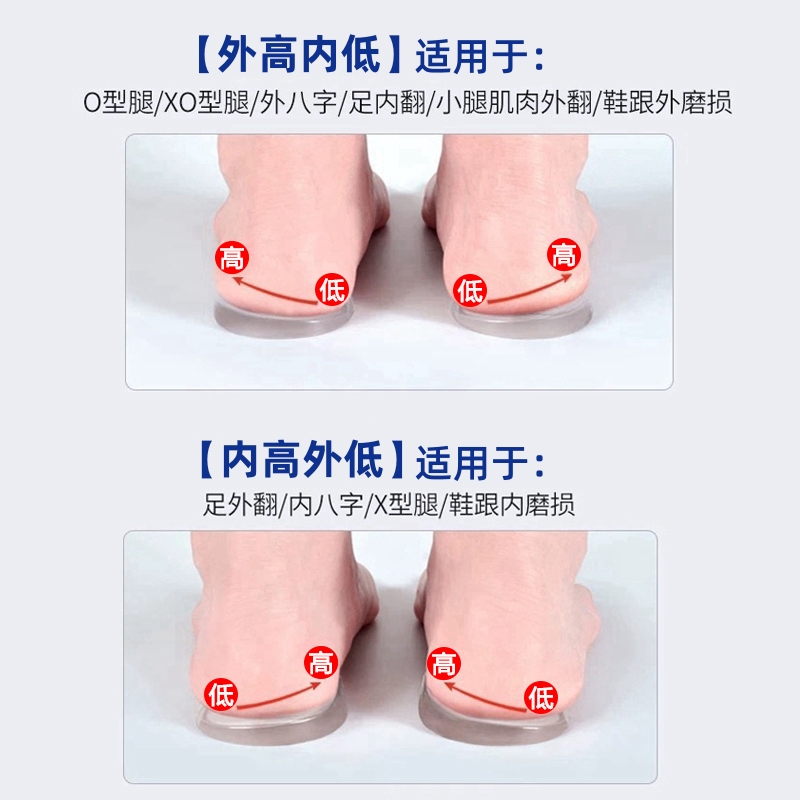 成人直腿神器o型X型小腿外翻矫正鞋垫扁平足弓支撑垫鞋防止鞋底磨 - 图2