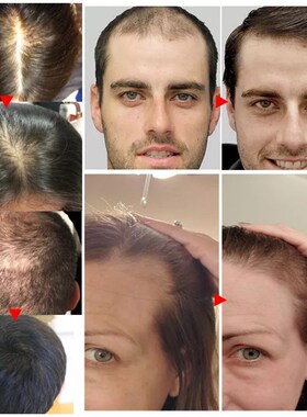 好货7 Days Ginger Hair Growth Products Natural Anti Hair Los