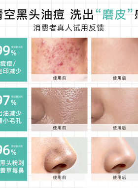 洗面奶洁面乳控油祛痘清洁缩毛孔
