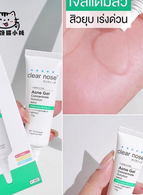泰国祛荳凝胶clearnose淡化荳印
