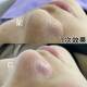 Hair follicle cleaning purifying cream salon ງາມພິເສດ facial facial sewage pore deep cleaning ຄີມນວດຝຸ່ນ