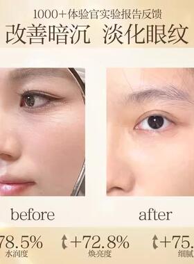 【官方正品】焕采红木籽淡纹眼部精华油紧致提拉修护眼周纹黑滚珠