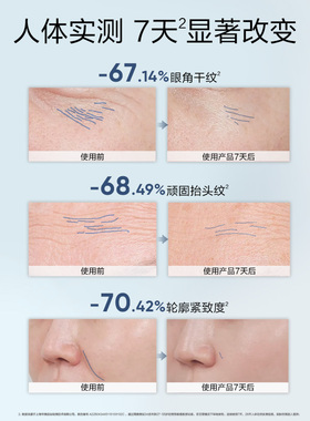 韩束男士冰露护肤品抗皱精华套装保湿洗面奶礼盒水乳控油补水送礼