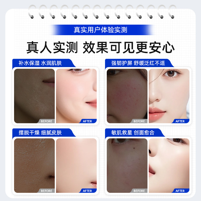 盛姿颖暗黄暗沉改善干燥次抛精华液医美术后可修护抗皱紧致胶原棒