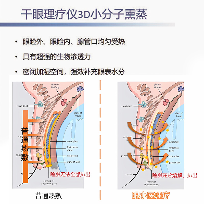 Eye Doctor Medical Dry Eye Physiotherapy Mirror