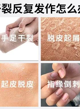 珀薇娜深海鱼油皲裂膏护手霜