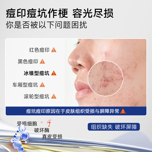 slot凝胶【院线同款】淡痘印slot硅酮凝胶evv凝胶rov硅酮凝胶mar - 图1