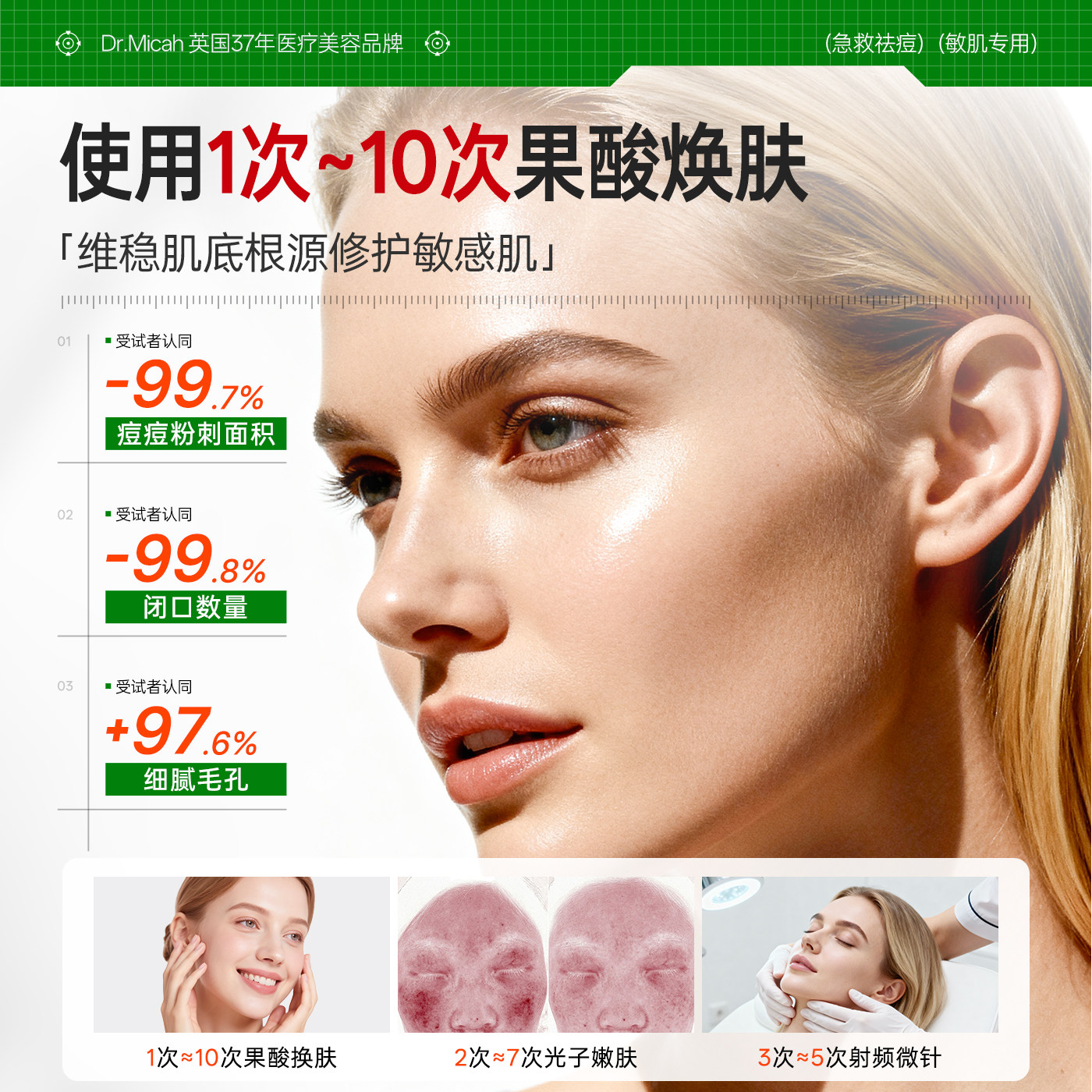 水杨酸棉片精华刷祛痘闭口粉刺黑头深层清洁湿敷收缩毛孔官方正品,淘宝优惠券,粉丝福利购,淘宝优惠卷