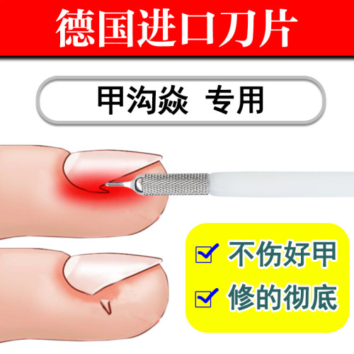 德国U型甲沟焱炎修甲刀指甲修脚工具家用指甲扎肉嵌甲修脚刀神器 - 图0