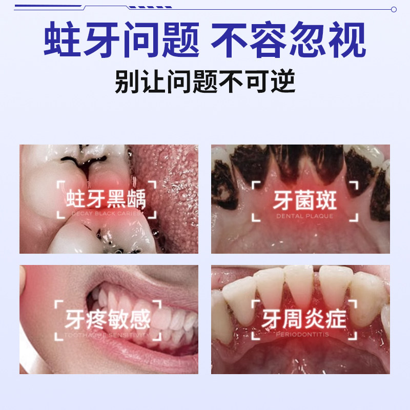 倍雅希含氟防蛀牙龋齿修复非牙膏成人专用防龋医用口腔防蛀膏正品,淘宝优惠券,粉丝福利购,淘宝优惠卷