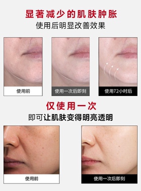 CANDORLOV彩多乐韩国氧气涂抹面膜清洁毛孔紧致温和保湿官方正品