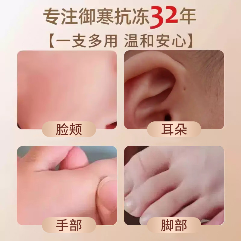 半瓶花冻伤膏儿童专用止痒冻伤膏疮防冻宝宝脸部耳朵手指老牌正品,淘宝优惠券,粉丝福利购,淘宝优惠卷