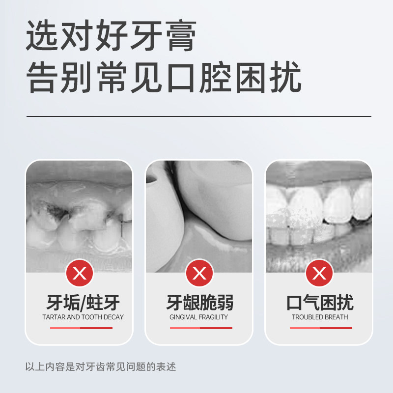 植护牙膏清新口气护齿护龈防蛀牙膏牙刷套装成人专用防蛀固齿牙膏