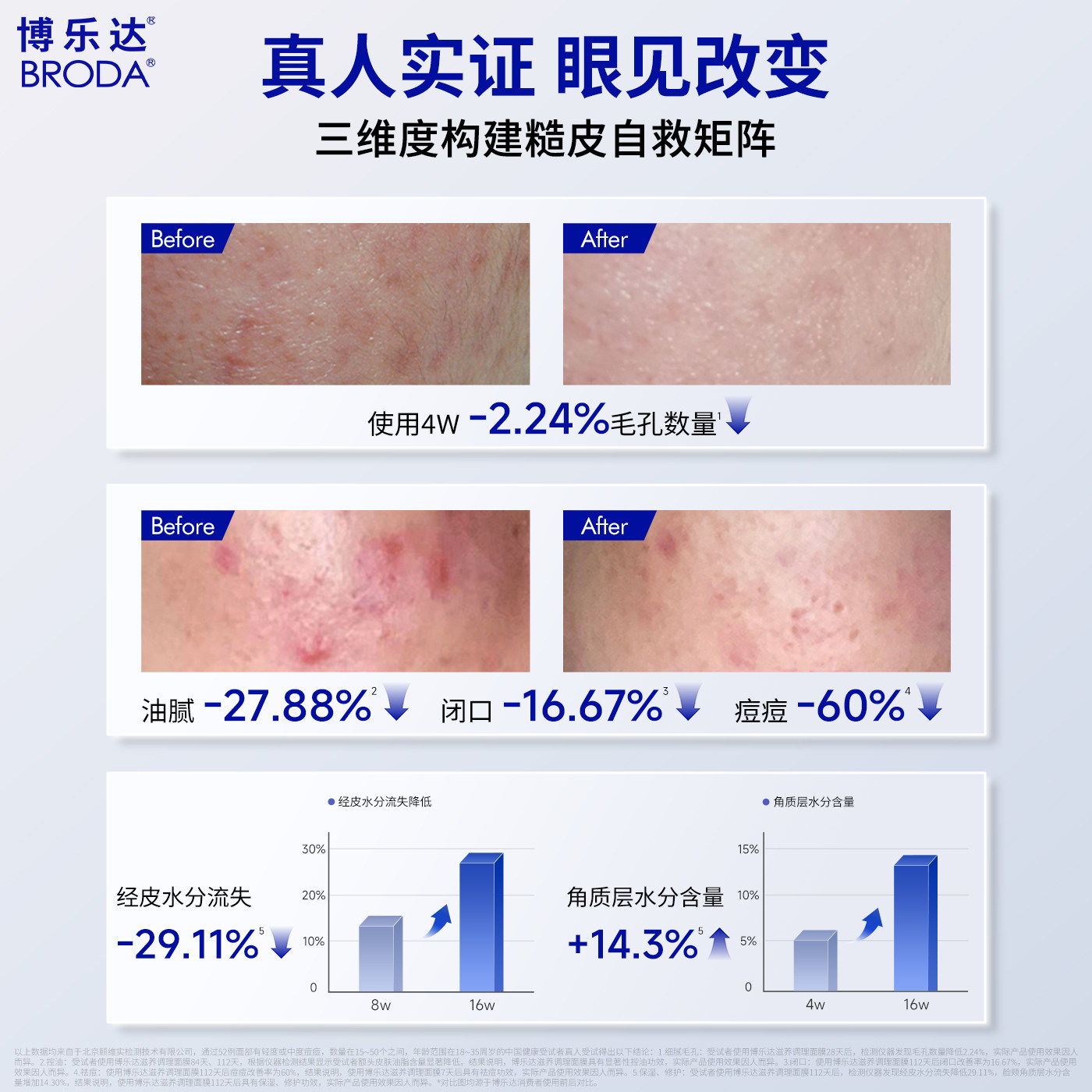 【交个朋友】博乐达水杨酸祛痘去黑头控油滋养调理涂抹面膜--