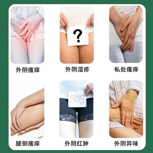 红霉素软丽尔维美私处女性消红肿疙瘩外阴瘙痒止痒消红肿祛异味 - 图0