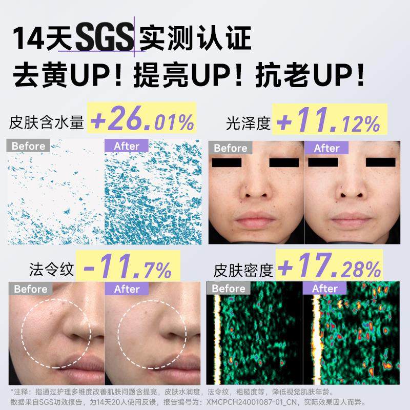 SILKPRO丝芙乐元气能量面部美容仪提拉紧致V脸部家用眼部导入仪器,淘宝优惠券,粉丝福利购,淘宝优惠卷