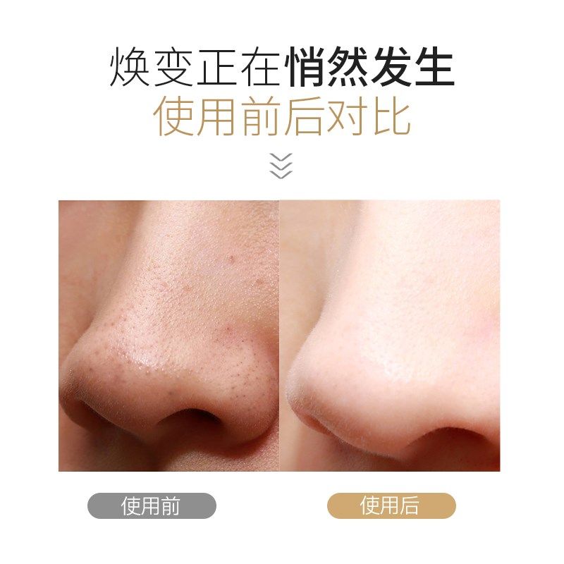 新款粉红色毛孔清洁器铲祛角质嫩肤仪器导入仪吸黑头神器美容仪器,淘宝优惠券,粉丝福利购,淘宝优惠卷