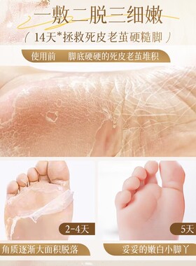 【5包10片】足膜女嫩白保湿滋润补水脚膜去死皮角质防干裂美足护