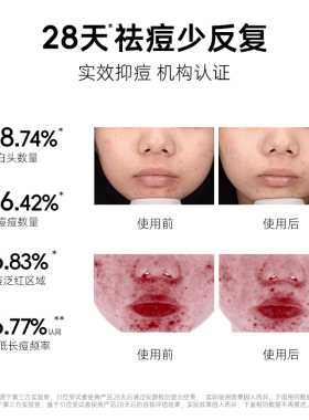 德玛工厂5.94%乳酸双酸祛痘精华