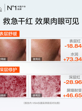 晒后急救修护屏障受损泛红肌肤