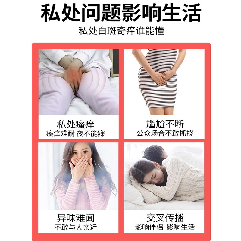 萎缩性外阴白斑消白软膏冰白黄体酮止痒膏去专用膏根抑菌私处正品,淘宝优惠券,粉丝福利购,淘宝优惠卷