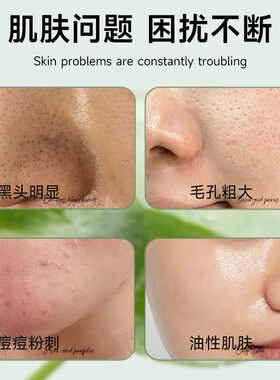 积雪草苷霜软膏痘坑印官方正品