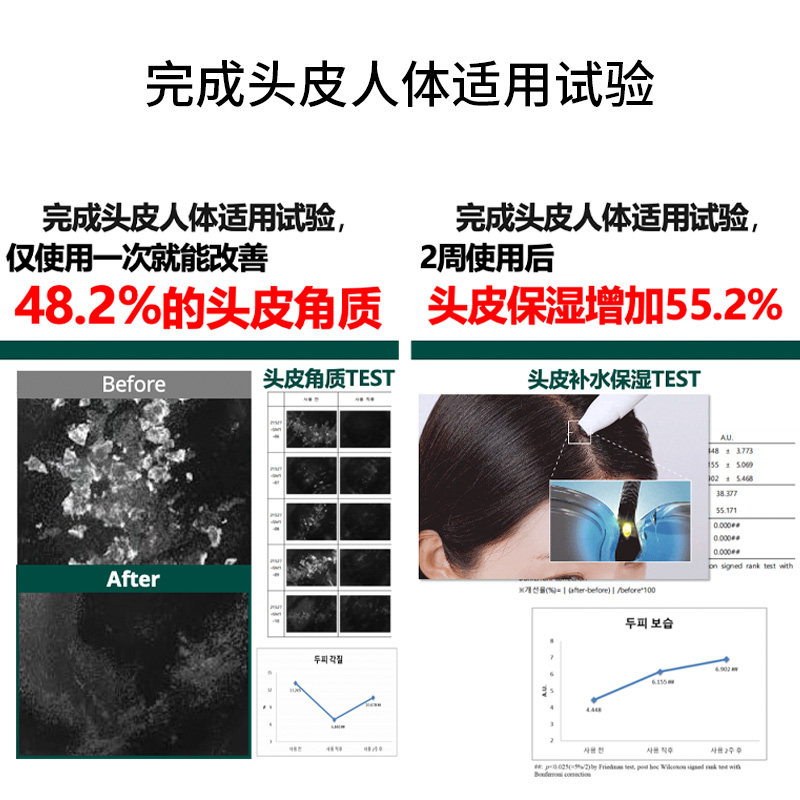 ViveLab头皮精华泡沫发际线增长液固发增发密发强韧防脱防掉发,淘宝优惠券,粉丝福利购,淘宝优惠卷