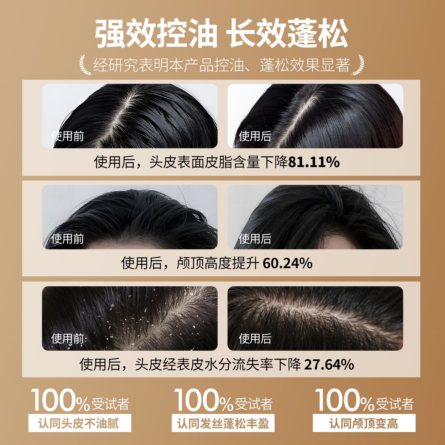 友理黄花蒿头皮素 敏感修护控油去屑清洁头皮洗发水急救装一盒6袋