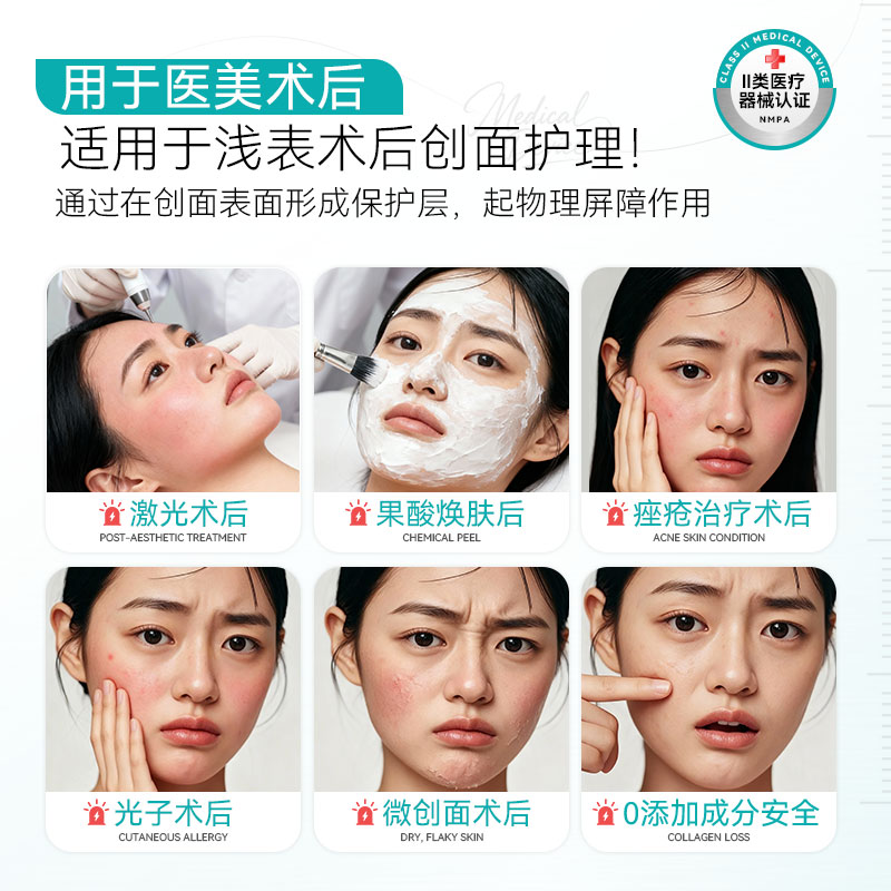 汇宝颜医用透明质酸钠敷料创面修复皮肤屏障受损护理非面膜冷敷贴 - 图0