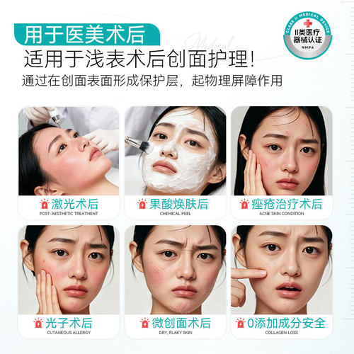 汇宝颜医用重组胶原蛋白喷雾医美术后创面修复敷料屏障受损护理 - 图0