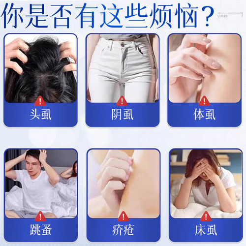 本田制药百部酊阴虱喷剂男女私处去虱子儿童头虱卵一扫光立净 - 图0