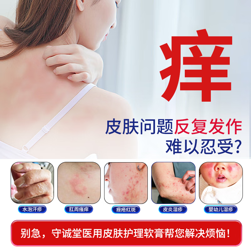 守诚堂医用皮肤护理软膏湿疹膏顽固皮炎湿疹止痒膏水泡湿疹瘙痒,淘宝优惠券,粉丝福利购,淘宝优惠卷