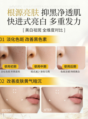 意肤淡斑霜改善暗沉匀净肤色护肤