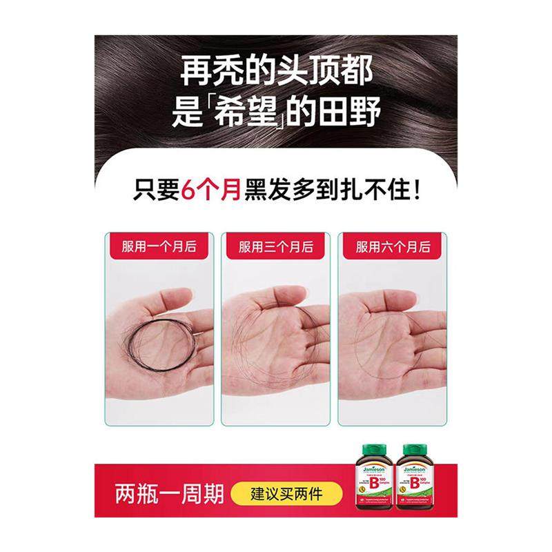 健美生生物素防脱发biotin维生素b6养发护发生长头发营养保健品,淘宝优惠券,粉丝福利购,淘宝优惠卷