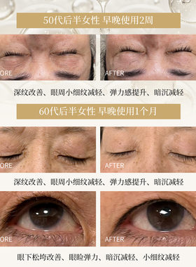 季令弹力眼霜提拉紧致定格眼龄