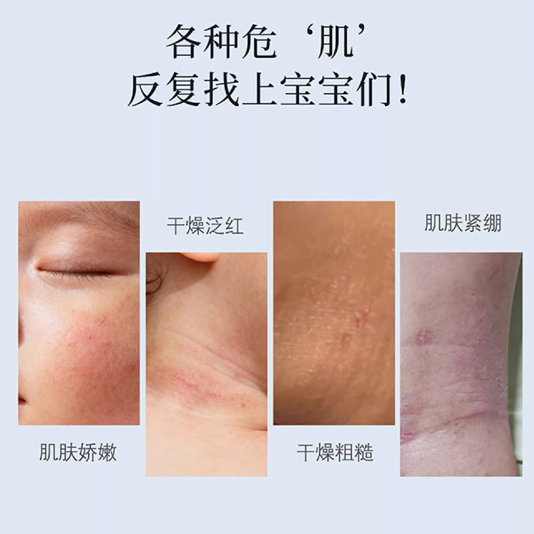 【U先试用】爱贝恋婴童保湿润肤精华霜25g苹果脸秋冬婴儿宝宝面霜,淘宝优惠券,粉丝福利购,淘宝优惠卷