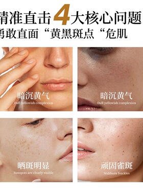 温泉之谜淡斑霜透亮美白肌肤淡化脸部黑黄晒斑黄褐斑雀斑厂家正品