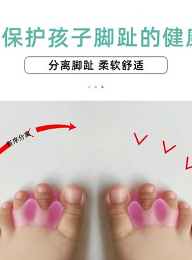 幼儿童脚趾矫正器食指重叠上翘中指内扣重叠弯曲脚趾头纠正分离J7