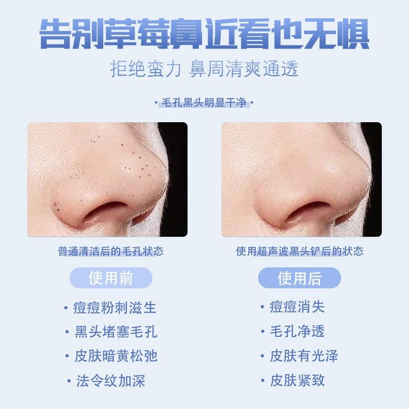 超声波铲皮机毛孔清洁器洁面去黑头铲美容仪器导入导出铲皮刀,淘宝优惠券,粉丝福利购,淘宝优惠卷