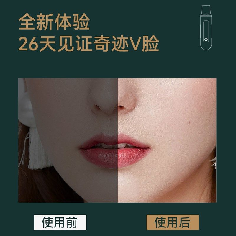 超声波黑头铲子吸黑头神器美容仪脸部毛孔清洁铲皮机按摩粉刺紧致,淘宝优惠券,粉丝福利购,淘宝优惠卷